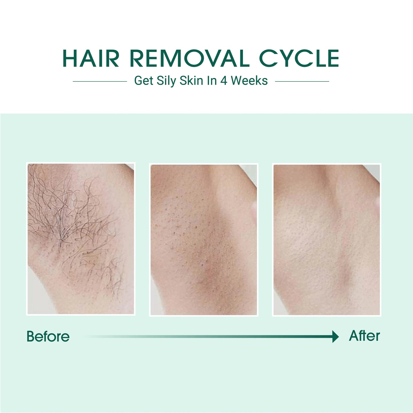 Laser IPL Hair Removal - HBeauty For Ever